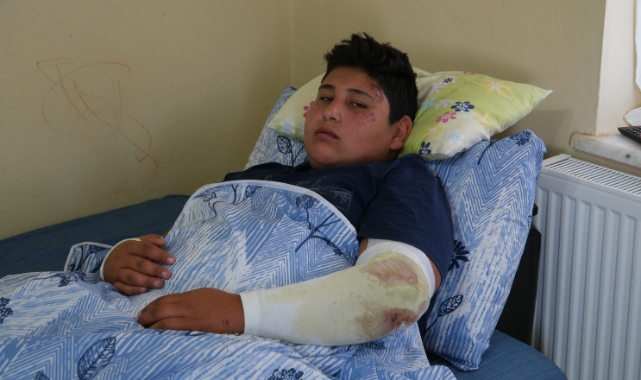 Sokak köpeklerinden kaçamadı!