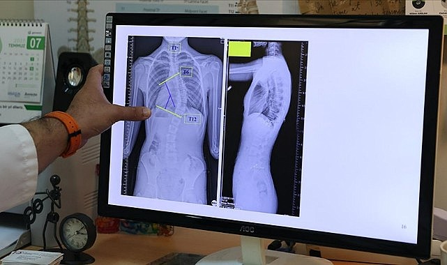 Çocuklarda ergenlik öncesine dikkat