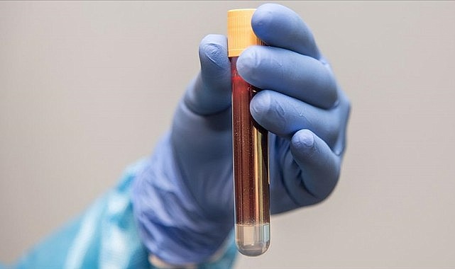 Erkeklere kan testi uyarısı