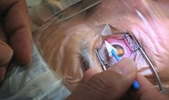 Karaman Eğitim ve Araştırma Hastanesinde çifte mağduriyet iddiası