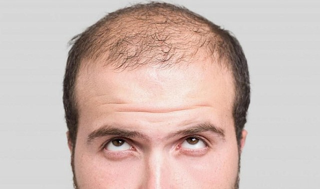 Nane yağı deyip geçmeyin…