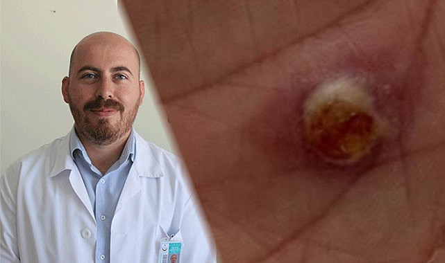 Bu belirtiler varsa hastaneye koşun!