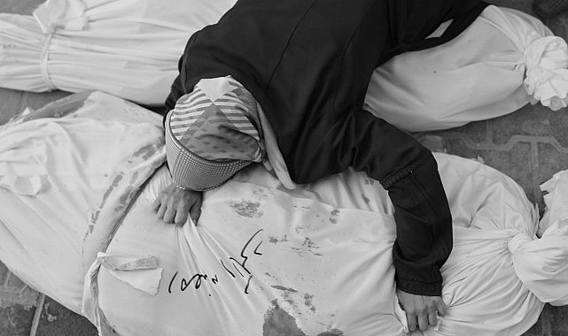 Gazze&#039;de yaralı sayısı ilk kez 100 bini geçti