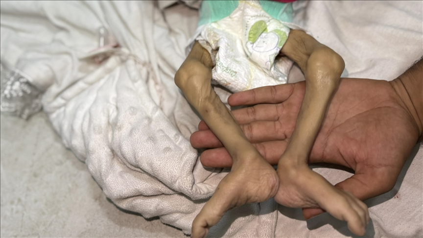 Açlıktan can verdi