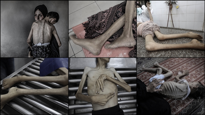 185 kişi açlıktan yaşamını yitirdi