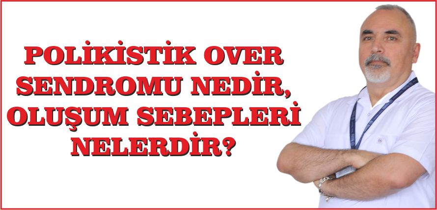 POLİKİSTİK OVER SENDROMU NEDİR, OLUŞUM SEBEPLERİ NELERDİR?