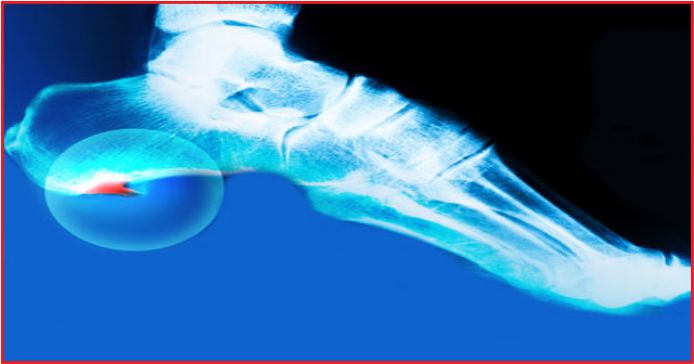 “ESWT YÖNTEMİ İLE AĞRILARINIZDAN KURTULMAK ARTIK DAHA KOLAY”