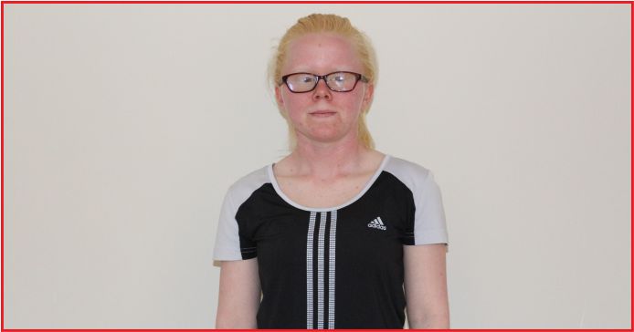 GÖRME ENGELLİ JUDOCU CAHİDE’DEN GÜMÜŞ MADALYA!