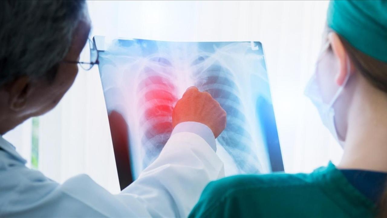 Akciğer kanserinde risk artışı