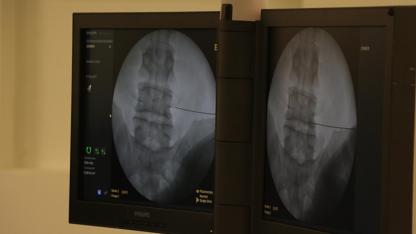 Ciddi risklere neden olabiliyor