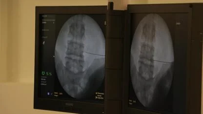 Ciddi risklere neden olabiliyor