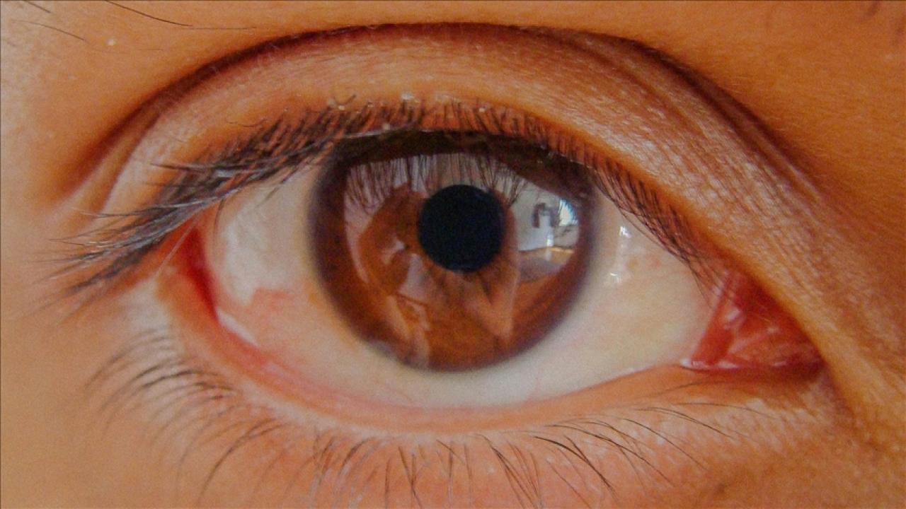 Göz tansiyonuna dikkat