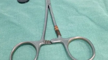 Karaman'da tuvaletini yapamayan çocuğun bağırsağından iki mıknatıs çıkarıldı